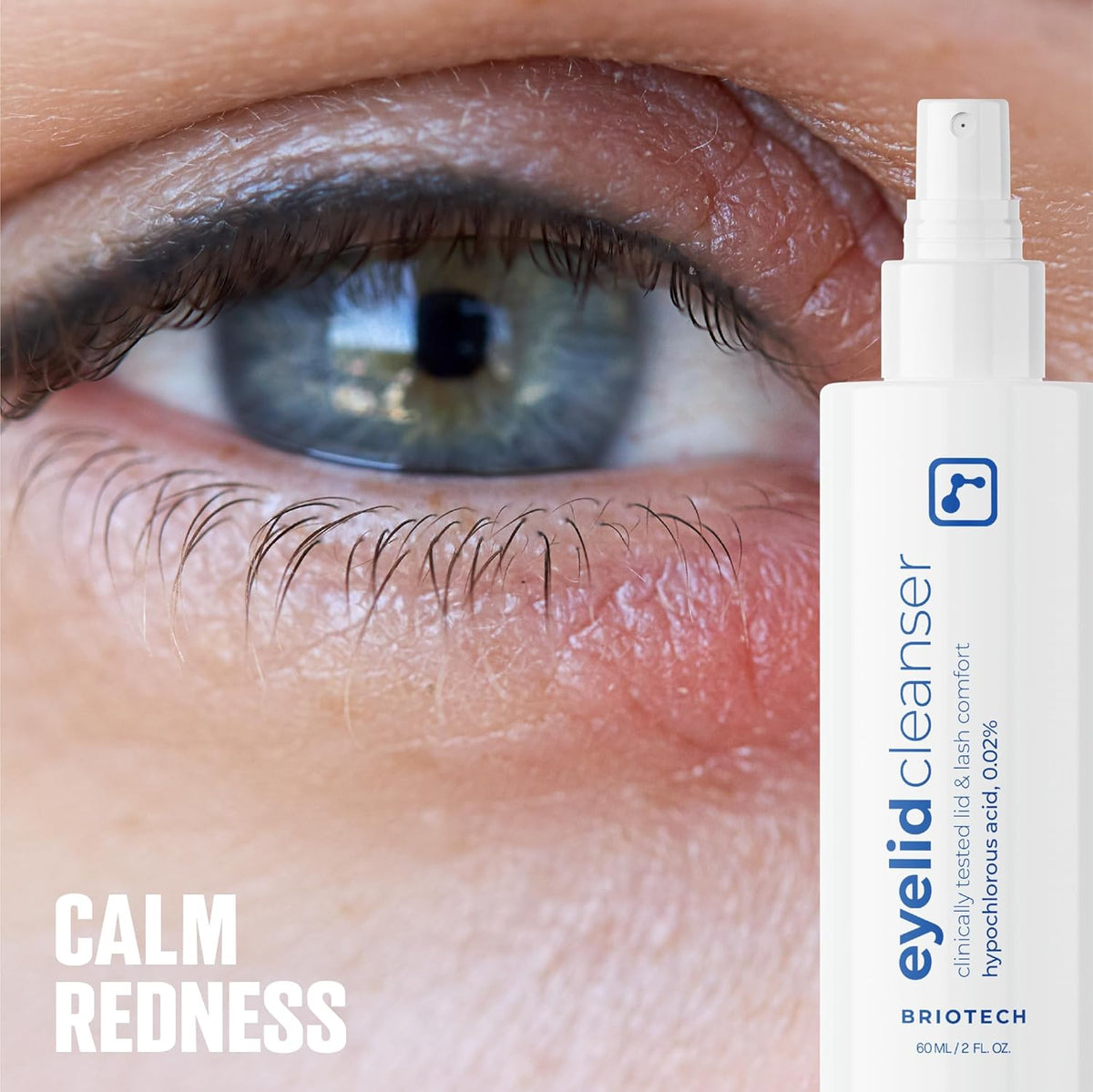 BRIOTECH Eyelid Cleanser, Hypochlorous Acid Spray, Lid & Eyelash Cleanser, Soothe Sensitivities, Calm Redness & Bumps, Support Against Irritation, Vegan, Travel Size 2 Fl oz (1 Pack)